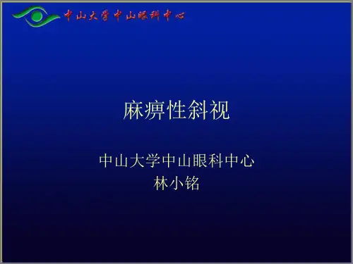 麻痹性斜视