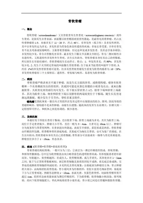 骨软骨瘤