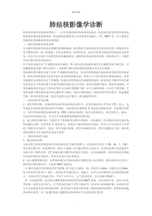 肺结核影像学诊断