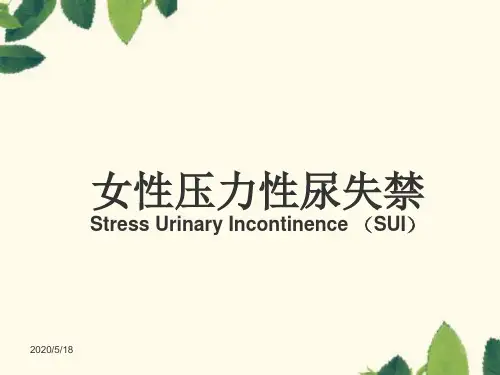 女性压力性尿失禁PPT课件