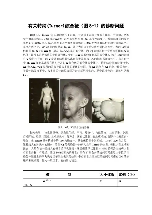 3-特纳综合征0725