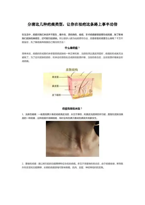 分清这几张种疤痕类型,让你在祛疤事这条路上事半功倍
