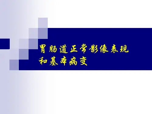 胃肠道-正常影像表现-基本病变