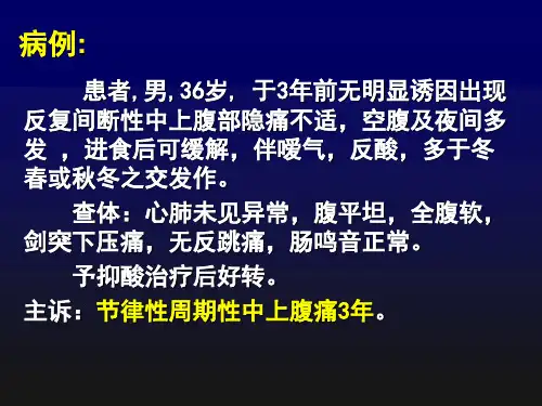 胃溃疡的简洁课件PPT