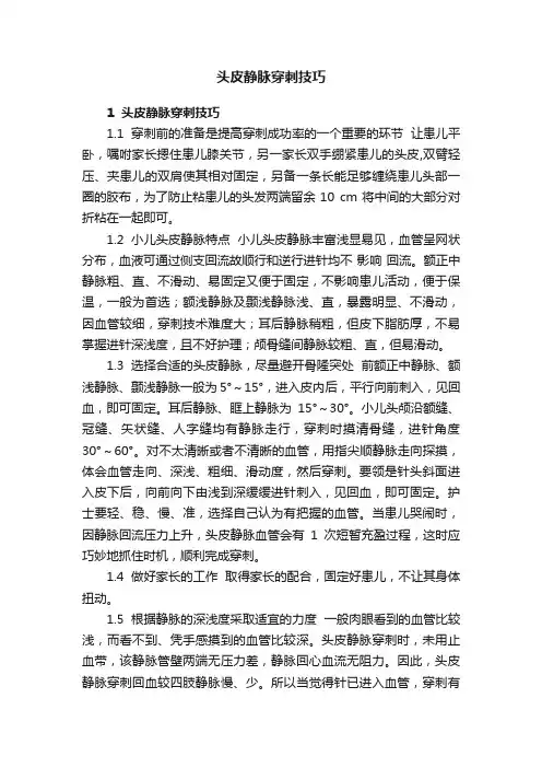 头皮静脉穿刺技巧