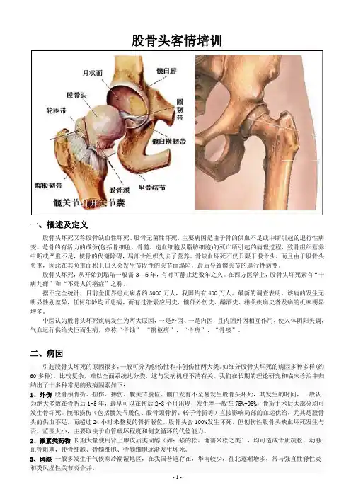 股骨头培训
