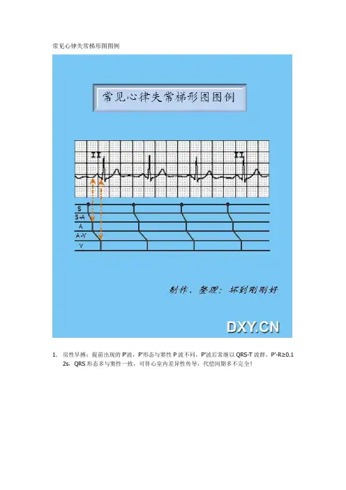 常见心律失常梯形图图例