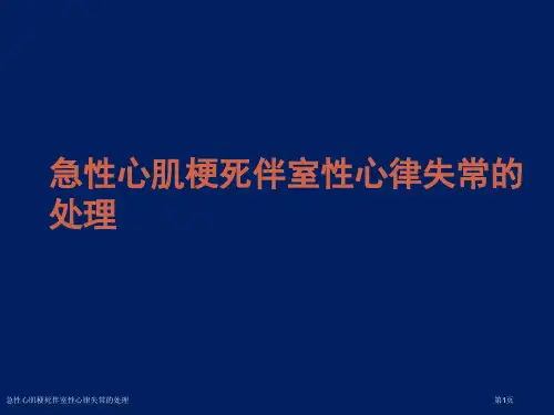 急性心肌梗死伴室性心律失常的处理