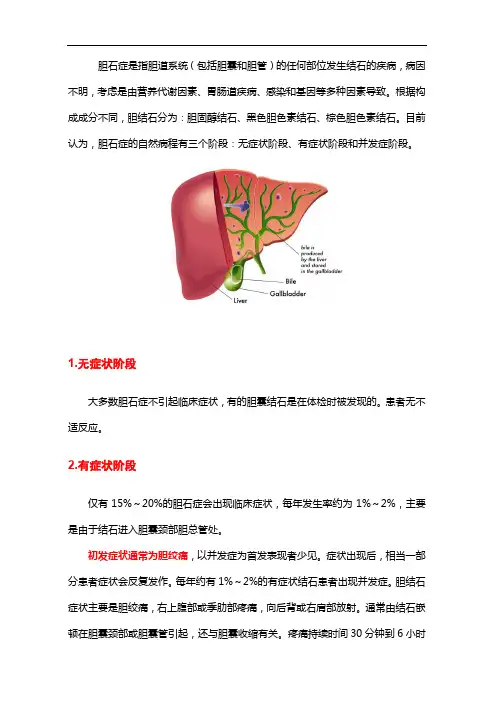 胆石症不同阶段及其临床表现