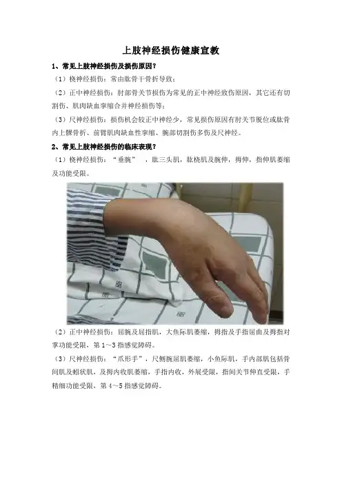 上肢神经损伤健康宣教