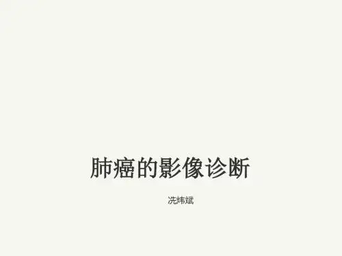 肺癌的影像诊断ppt课件