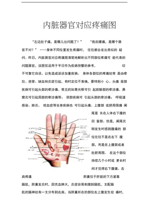 身体疼痛对应器官疾病示意图