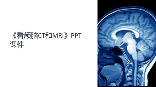 《看颅脑CT和MRI》课件