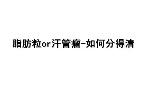 脂肪粒or汗管瘤-如何分得清