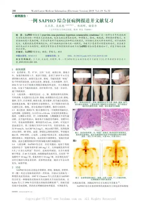 一例SAPHO 综合征病例报道并文献复习