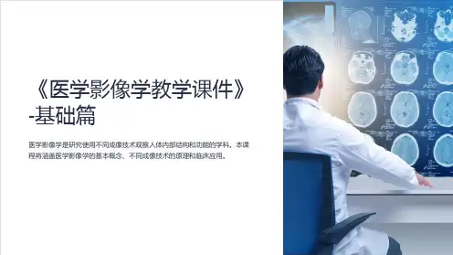 《医学影像学教学课件》-基础篇