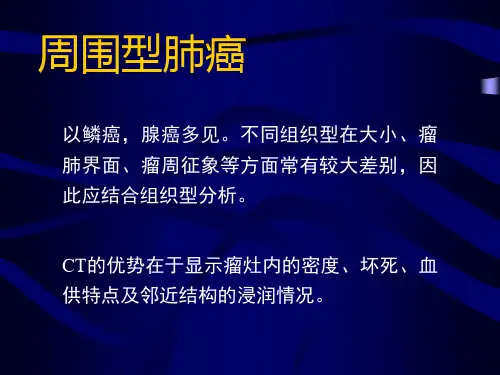 【影像诊断课件】周围型肺癌