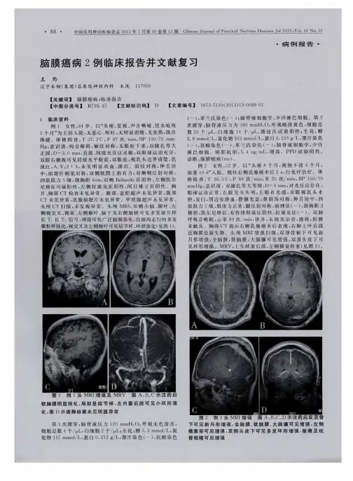 脑膜癌病2例临床报告并文献复习
