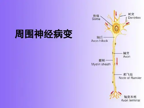 周围神经病变 共100页PPT资料