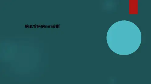脑血管疾病mri诊断