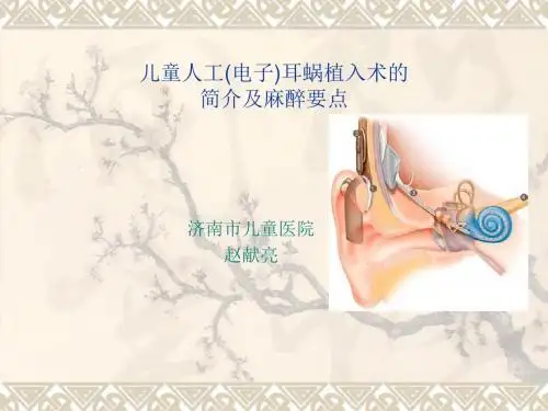 儿童人工耳蜗植入术的简介及麻醉要点 PPT课件