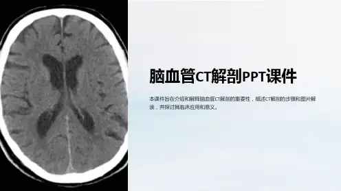 脑血管CT解剖课件