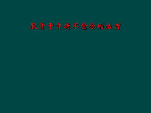 股骨干骨折不愈合的治疗