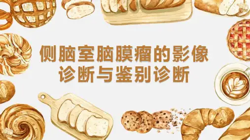 侧脑室脑膜瘤的影像诊断与鉴别诊断