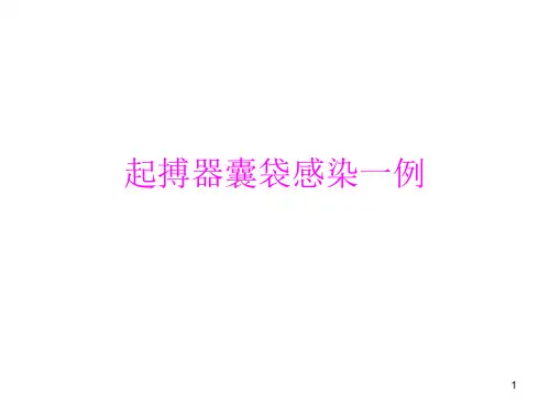 起搏器囊袋感染ppt课件