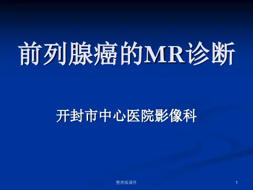 前列腺癌的MR诊断ppt课件