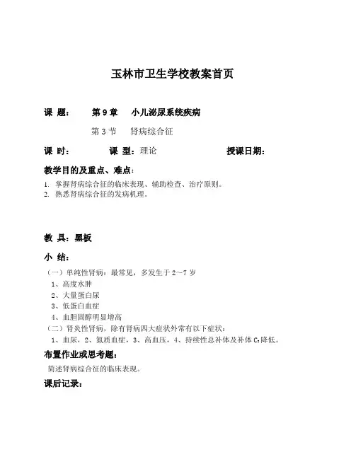 肾病综合征