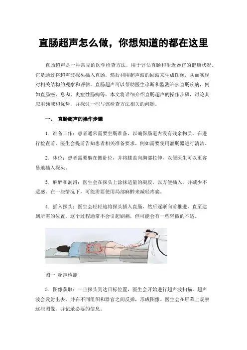 直肠超声怎么做，你想知道的都在这里