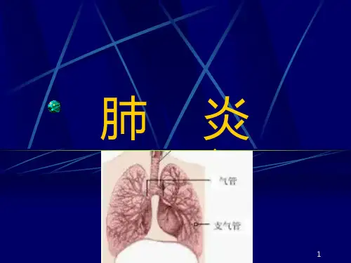 肺炎PPT课件