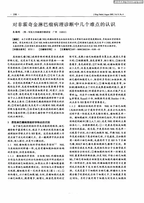 对非霍奇金淋巴瘤病理诊断中几个难点的认识