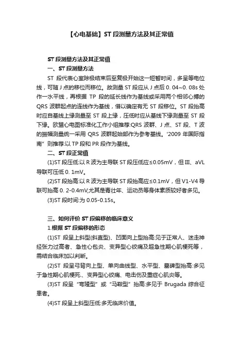 【心电基础】ST段测量方法及其正常值