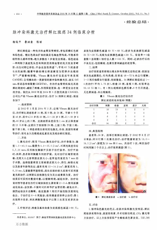 脉冲染料激光治疗鲜红斑痣34例临床分析