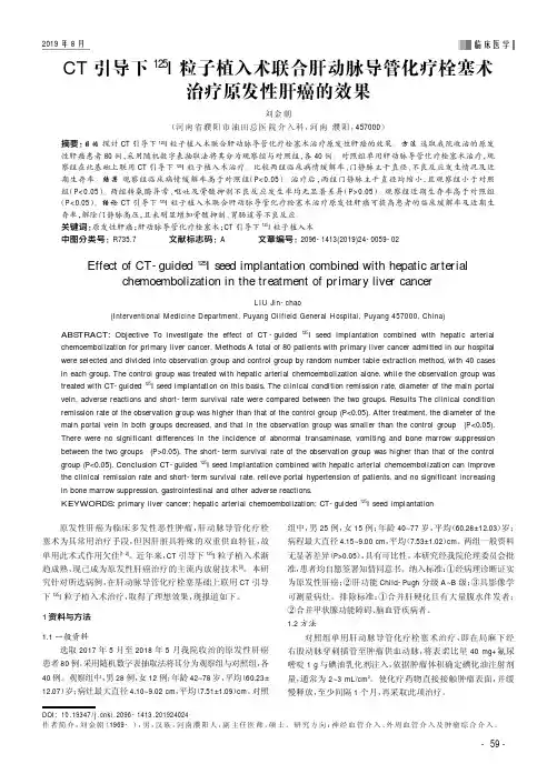 CT引导下^125I粒子植入术联合肝动脉导管化疗栓塞术治疗原发性肝癌的效果