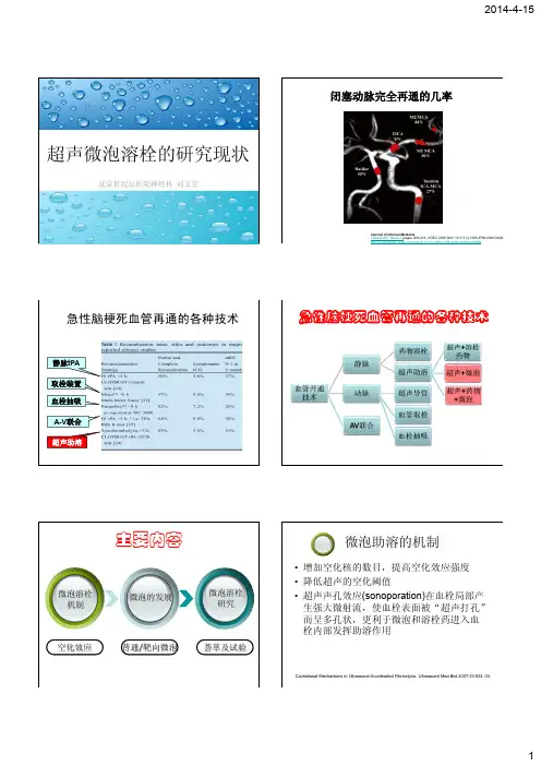 超声微泡溶栓的研究现状-刘文宏
