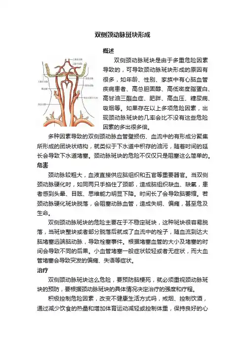 双侧颈动脉斑块形成