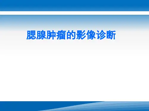 腮腺肿瘤影像学诊断