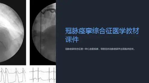 冠脉痉挛综合征医学教材课件