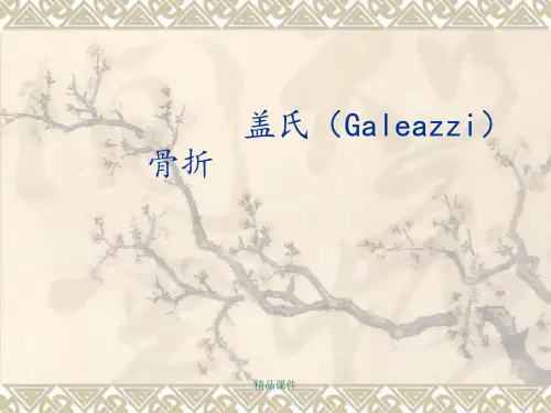 骨科讲义盖氏骨折