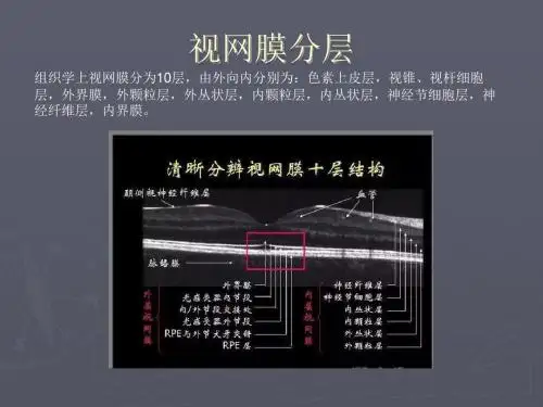 眼底病1