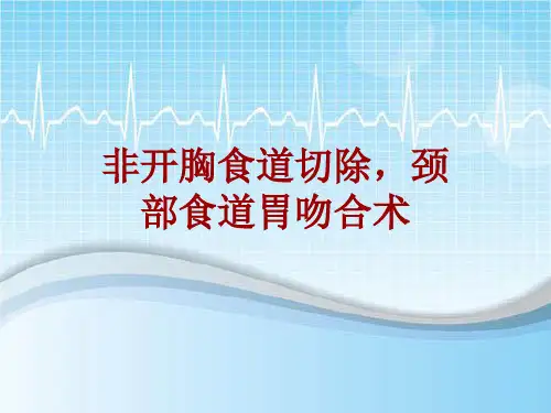 手术讲解模板：非开胸食道切除,颈部食道胃吻合术