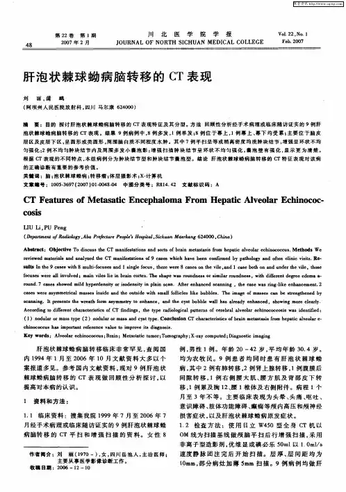 肝泡状棘球蚴病脑转移的CT表现
