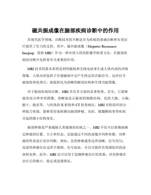 磁共振成像在脑部疾病诊断中的作用