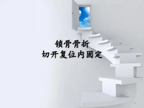 锁骨骨折切开复位内固定PPT课件