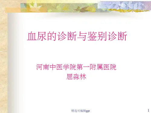 血尿的诊断与鉴别诊断