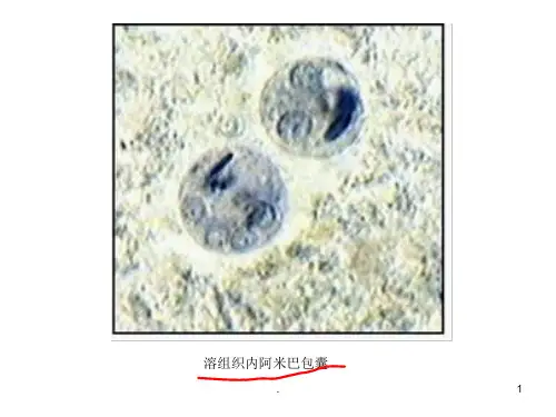 寄生虫考试PPT课件