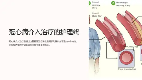 冠心病介入治疗的护理终